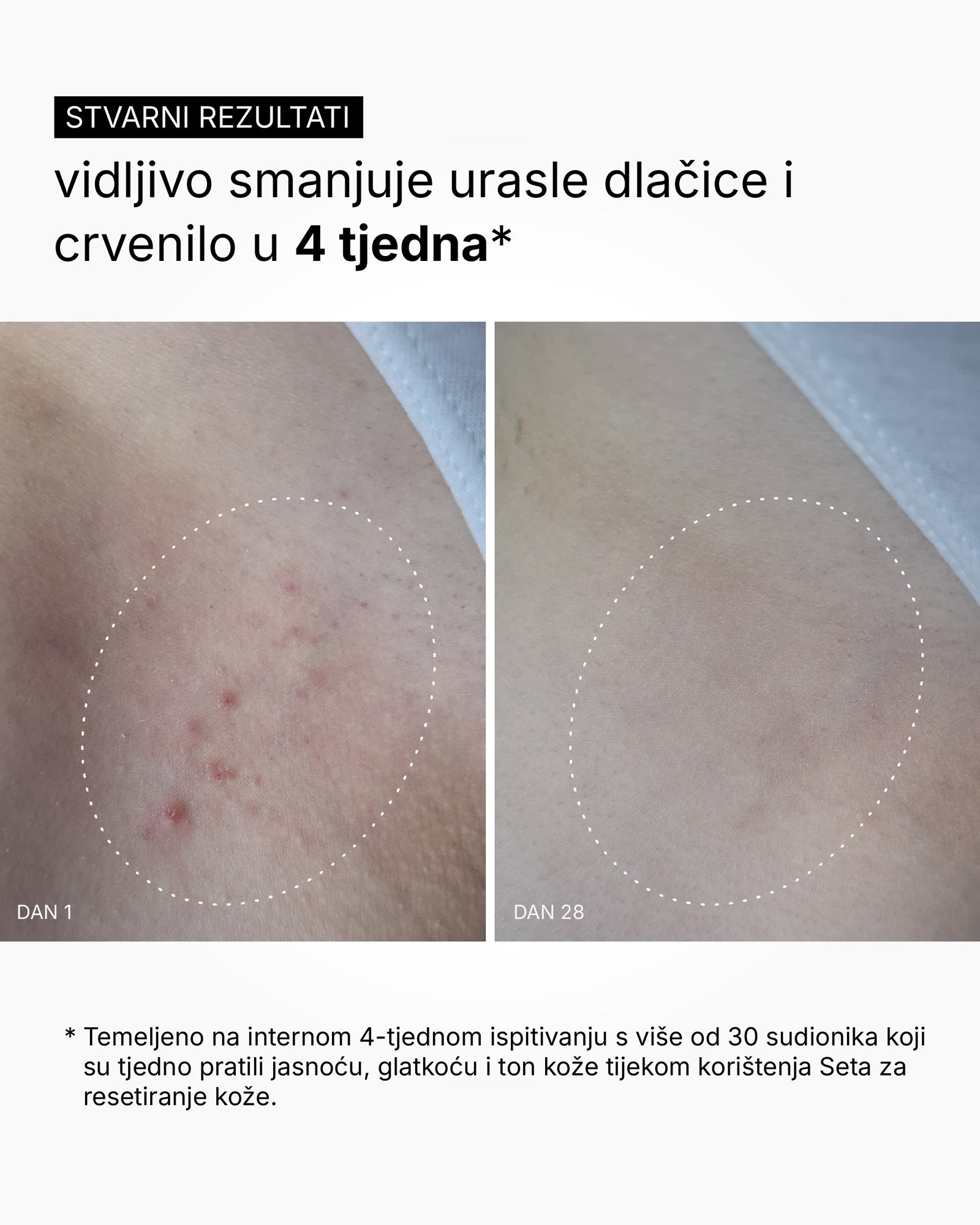 Skin Reset Set - Full Body Routine