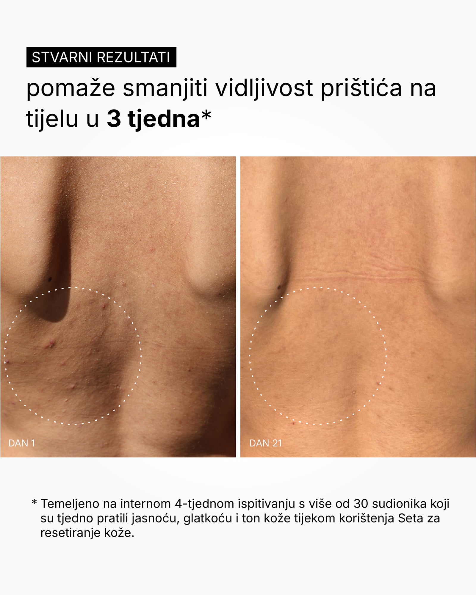 Skin Reset Set - Full Body Routine