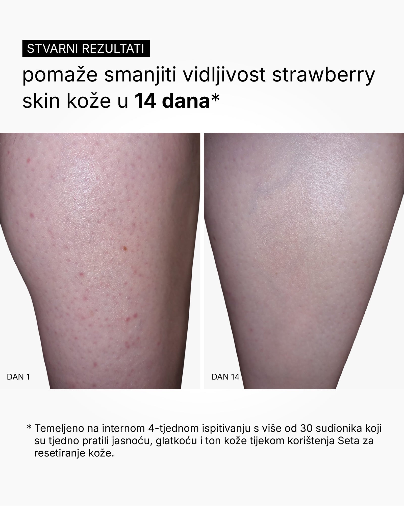 Skin Reset Set - Full Body Routine